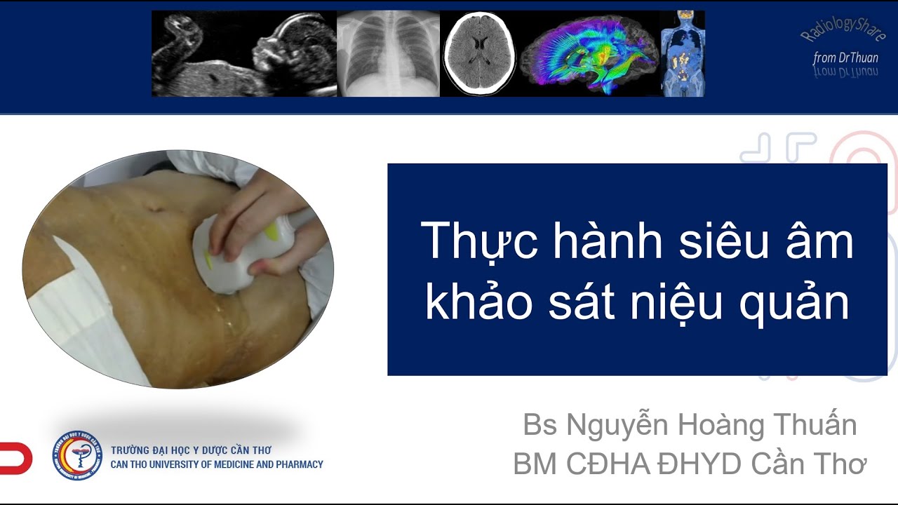 Kỹ thuật khảo sát niệu quản