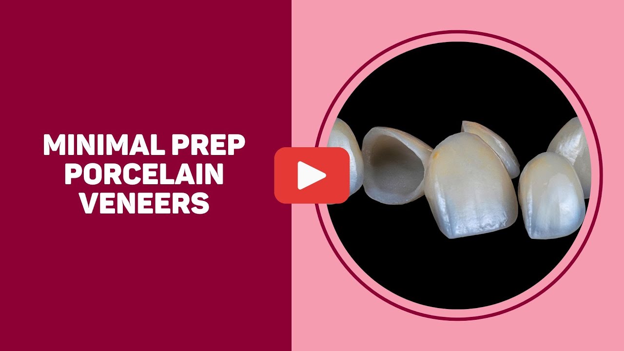 Cosmetic Dentistry using minimal preparation porcelain veneers