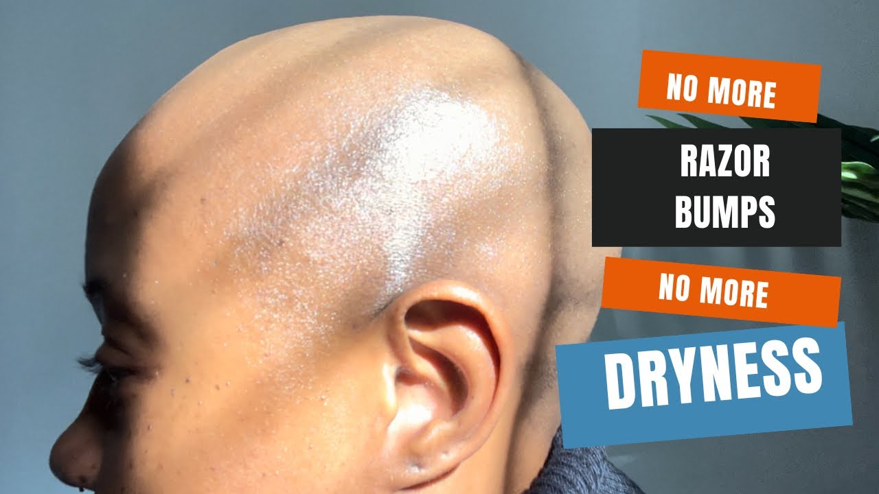 HEALTHY SCALP ROUTINE FOR BALD WOMEN 👋🏾say goodbye 2 RAZOR BUMPS, DRYNESS & DISCOLORATION