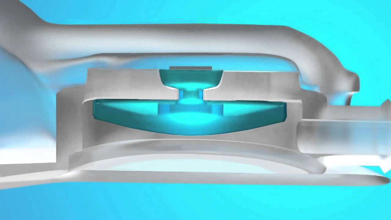 The Form and Function of Medtronic Shunt Valves
