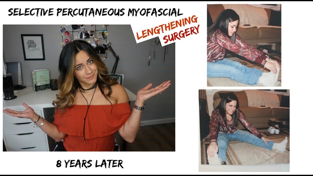 My 8 year “surger-versary” with SPML