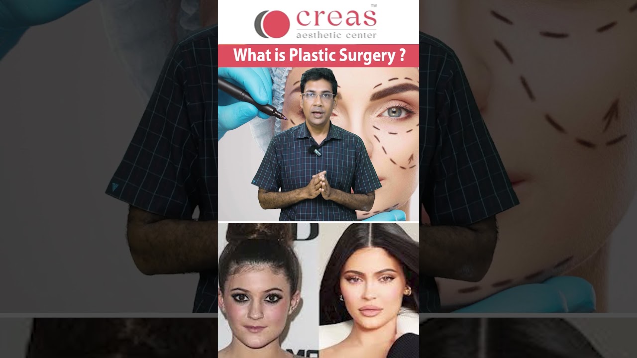 Is Plastic Surgery Danger? | பிளாஸ்டிக் சர்ஜரி என்பது என்ன?