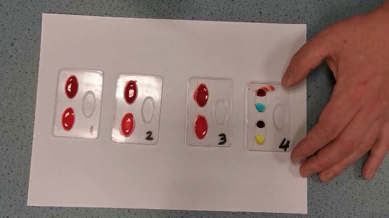 Practicum bloedgroepen bepalen