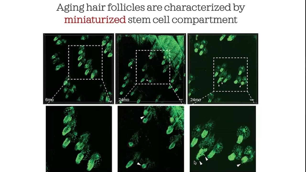 Visualizing cell activities during hair follicle aging - Rui Yi