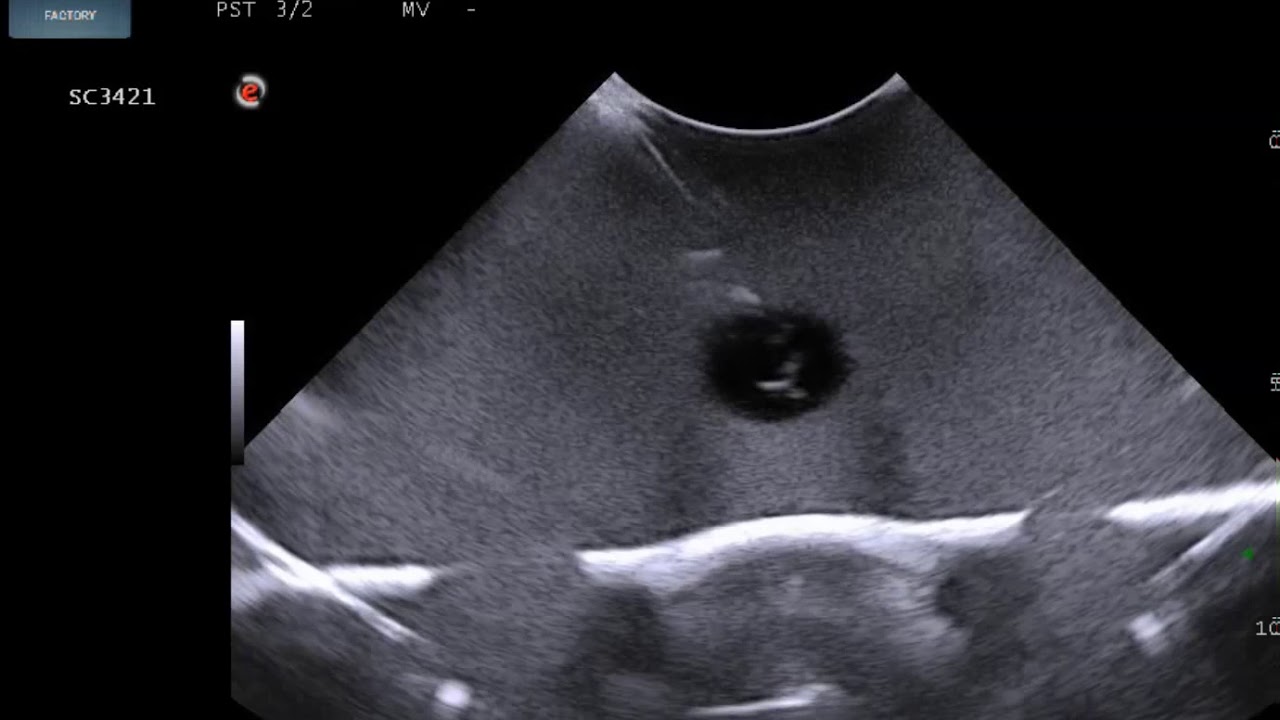 CAE Blue Phantom Sciatic Nerve Regional Anaesthesia Ultrasound Training Model