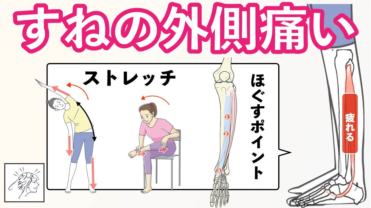 すねの外側が痛い原因とほぐしたいポイント＋対策ストレッチ