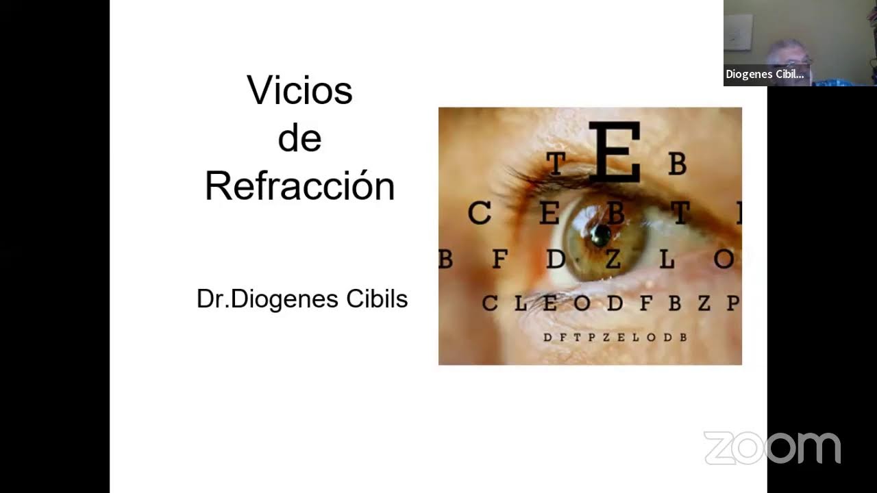 Vicios de refraccion. 17.11.22