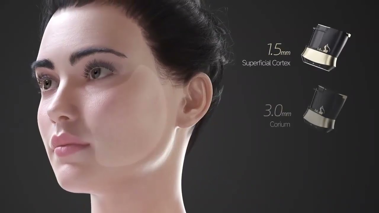 Feier a 22D Max 12D 9D 7D High Intensity Focused Antiaged Face Lifting Tighten Wrinkle Remove Lipoma