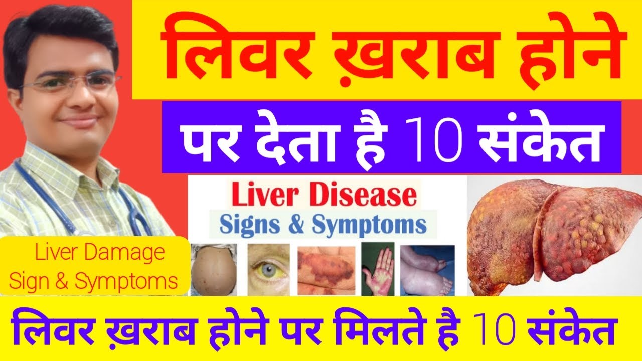 लिवर ख़राब होने से पहले देता है ये 10 संकेत | Liver Kharab Hone Ke Lakshan | liver damage symptoms