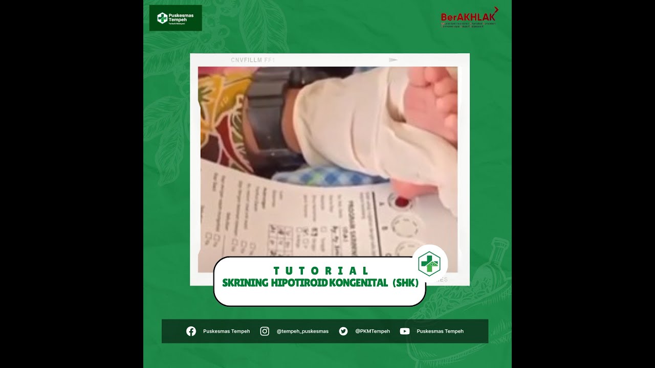 Tutorial Skrining Hipotiroid Kongenital (SHK) pada Bayi
