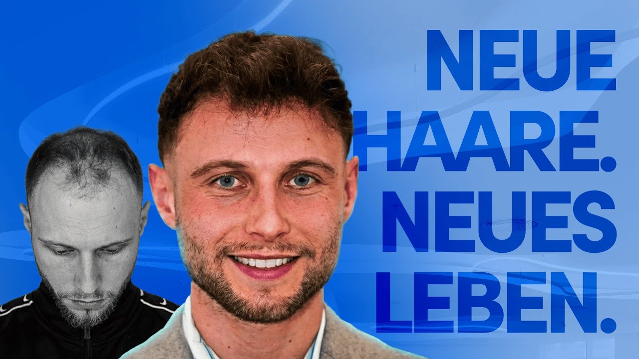 Haartransplantation in der Türkei: Wie Niklas mit 28 neues Selbstbewusstsein fand | #ElitNewYear