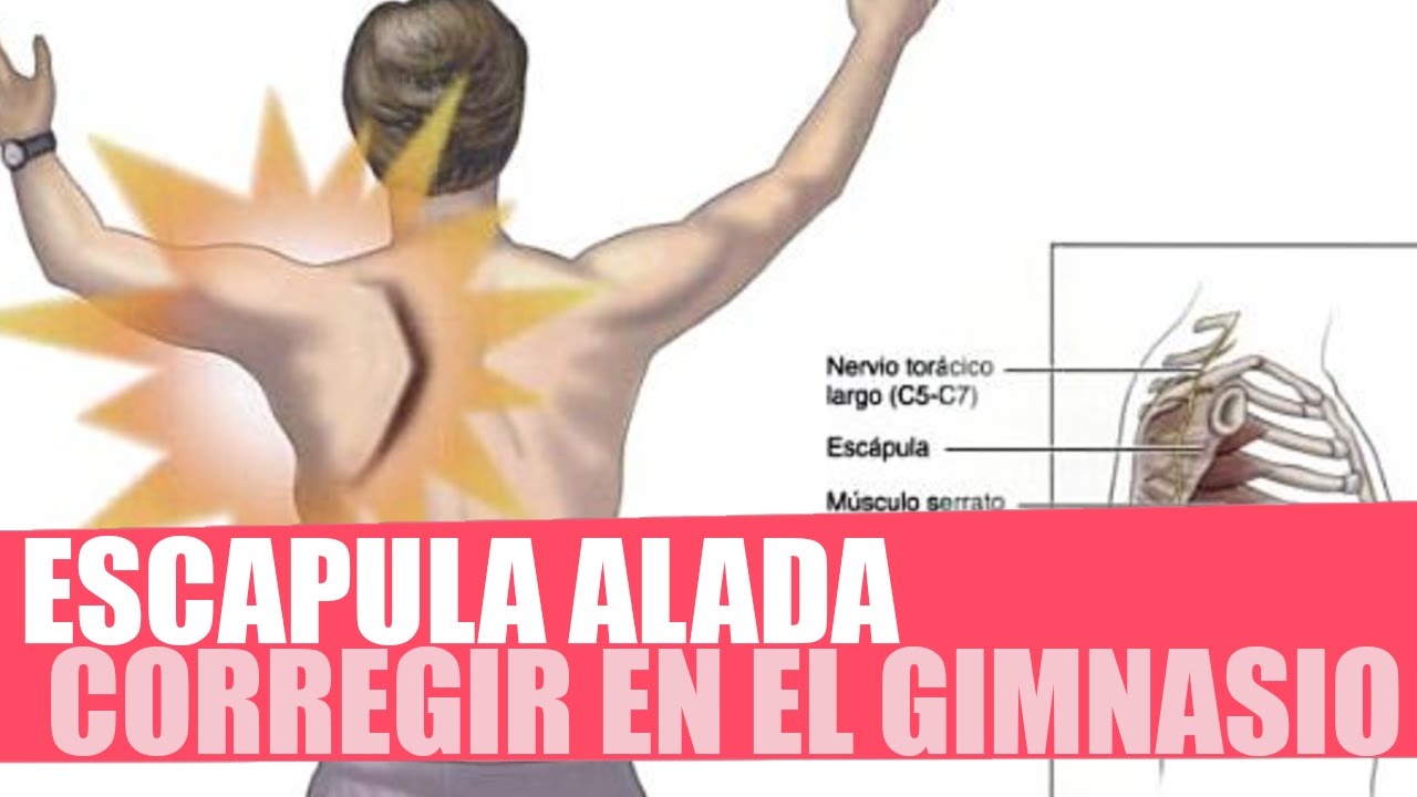 ESCÁPULA ALADA - CORREGIR EN EL GIMNASIO (Entrenamiento y ejercicios de serrato anterior)