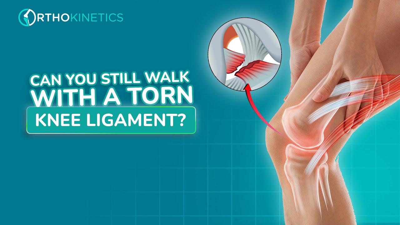 Can You Still Walk with a Torn Knee Ligament? | Dr Sean Leo