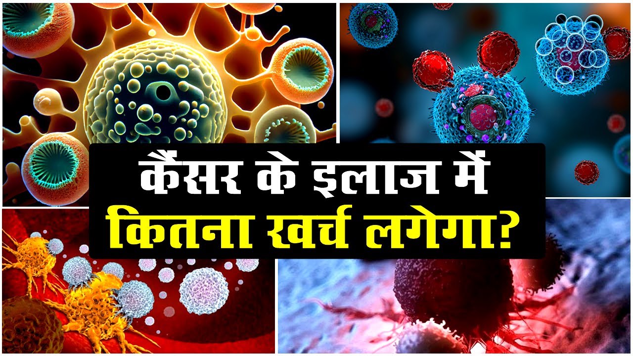 कैंसर के इलाज में कितना खर्च लगेगा? Devi Ahilya Cancer Hospital Indore
