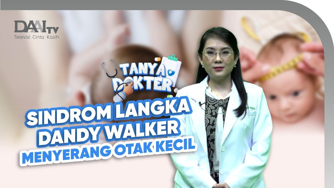 Dandy Walker Syndrom Serang Anak Tanpa Gejala