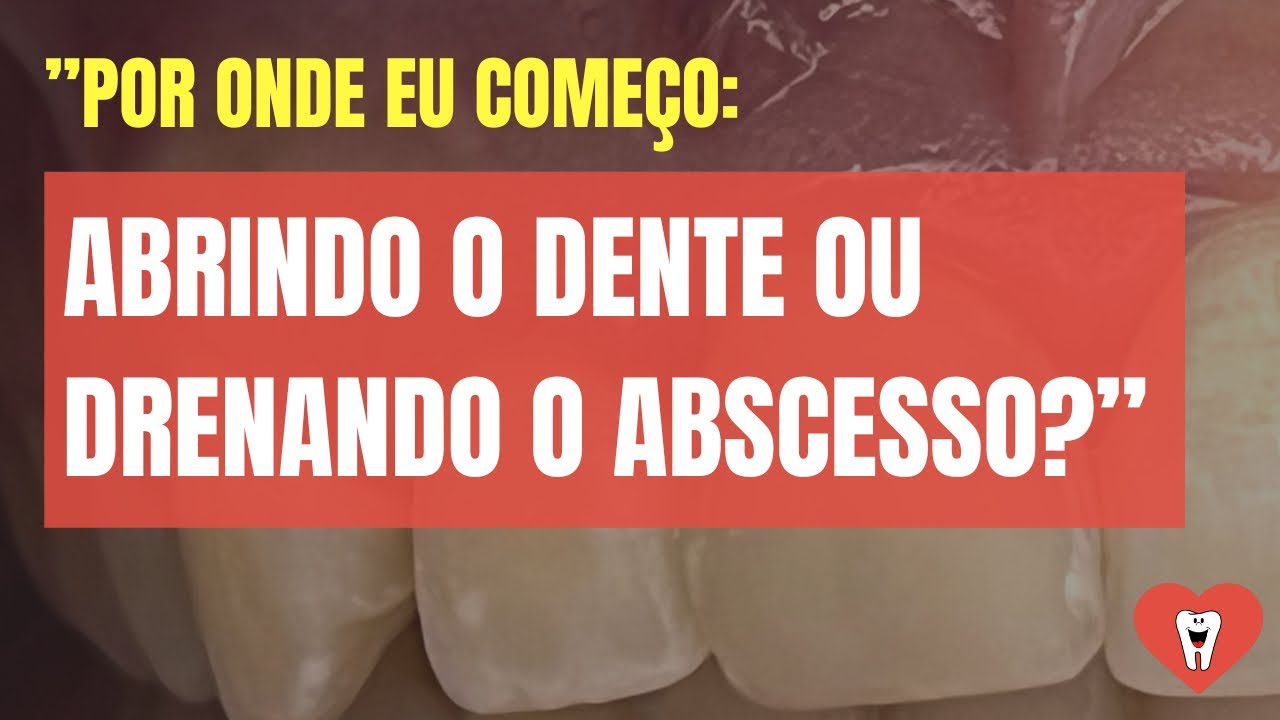 PACIENTE COM ROSTO INCHADO: ABRO O DENTE OU DRENO O ABSCESSO?