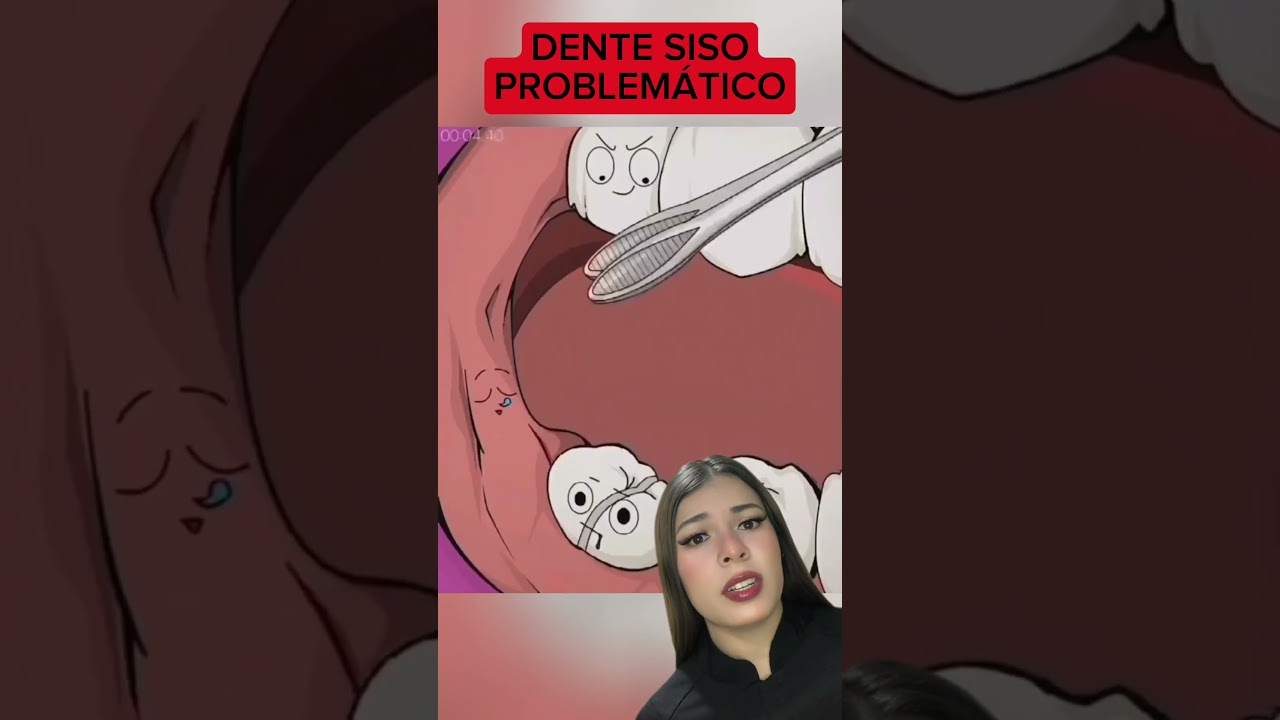 Gengiva Inflamada melhora assim! 😱🦷 #shorts