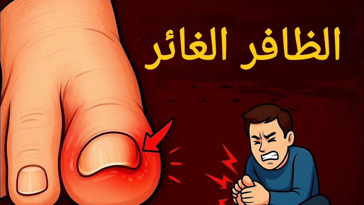 الظافر الغائر