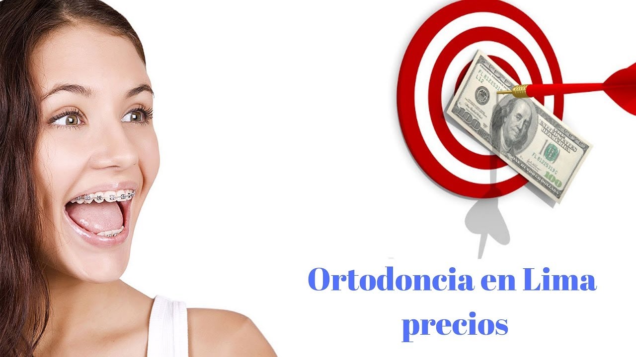 ortodoncia lima precios - Dr- Hermes Huertas- est&eacute;tica dental y ortodoncia en lima per&uacute;