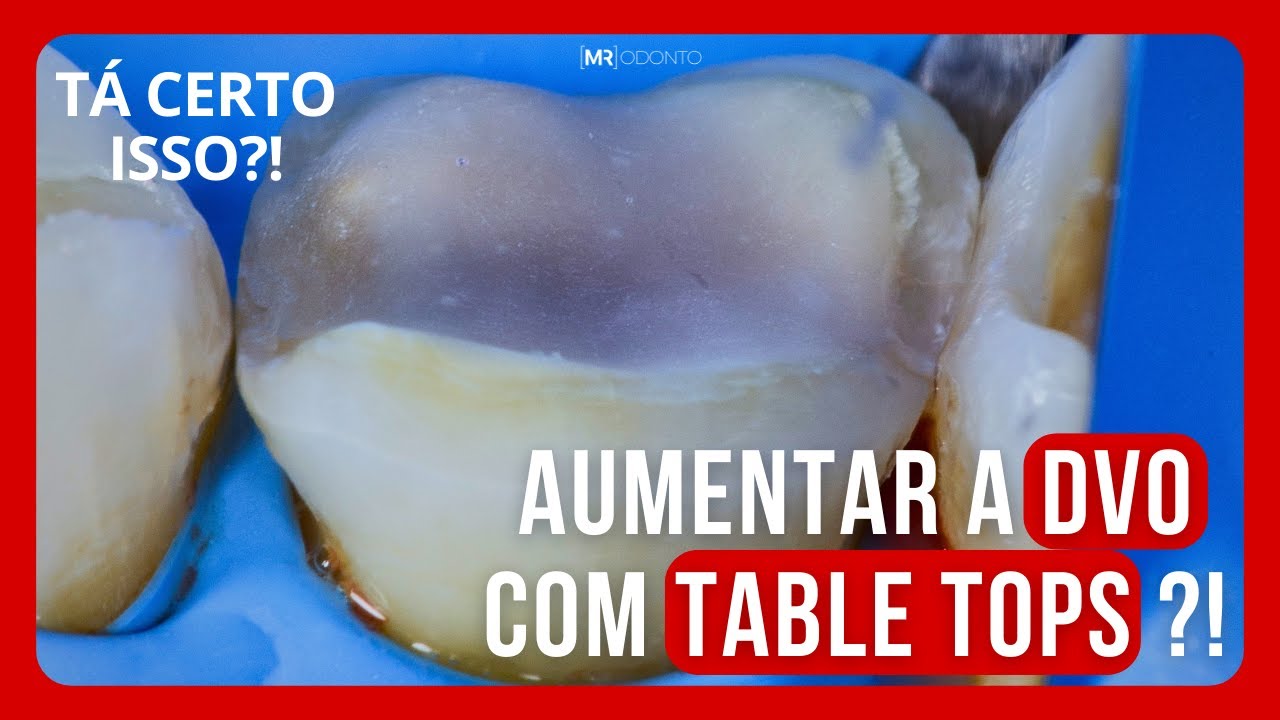 AUMENTAR A DVO COM TABLE TOPS!?