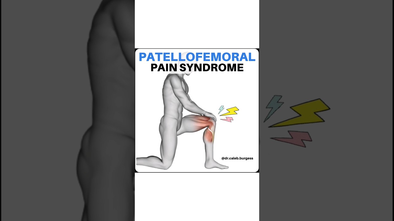Patellofemoral Pain - Rehab Exercises #kneepain #kneecap #patellofemoral #kneerehab #patellarpain