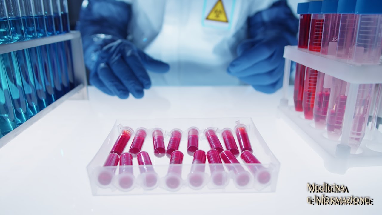 TUMORI DEL SANGUE:  CELLULE CAR-T INGEGNERIZZATE PER RICONOSCERE LE CELLULE TUMORALI E DISTRUGGERLE