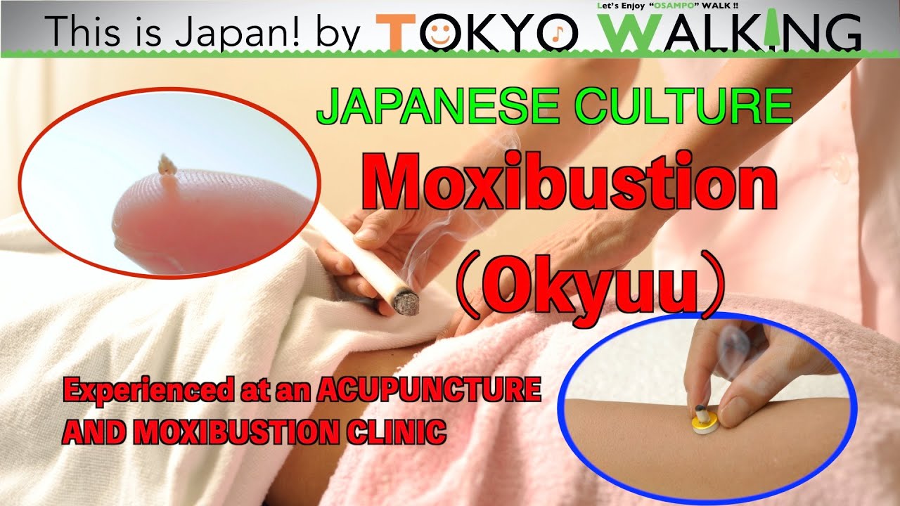 [This is Japan!] Okyuu at an ACUPUNCTURE AND MOXIBUSTION CLINIC