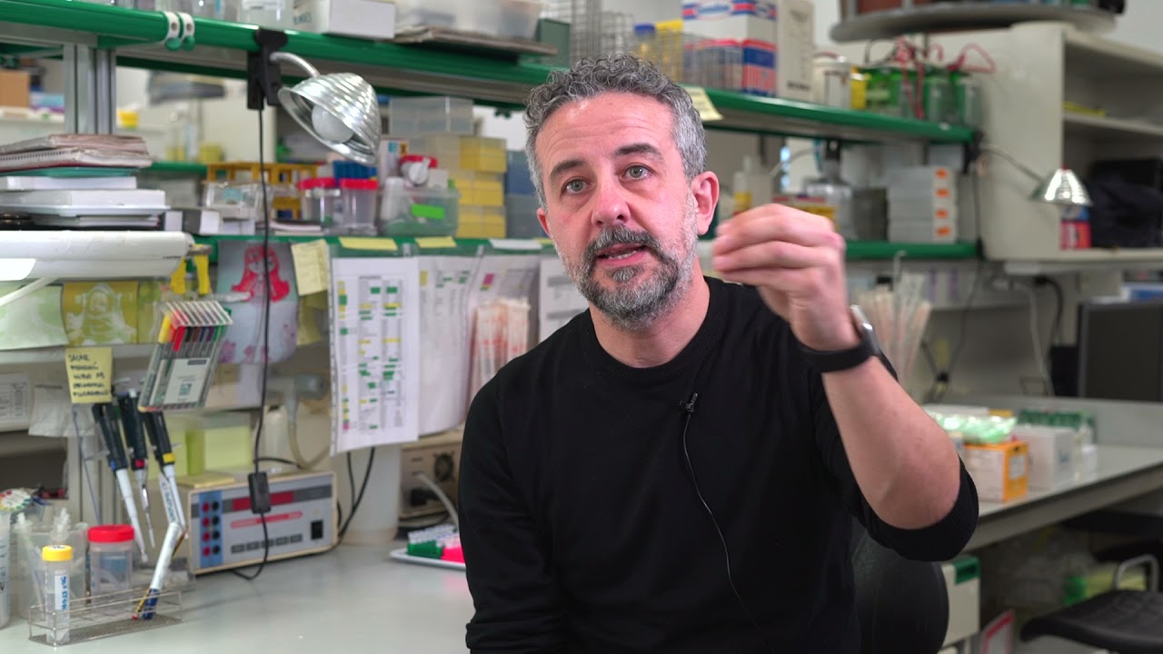 Scientists at IRB Barcelona discover the cause of neurodegeneration in Lafora disease