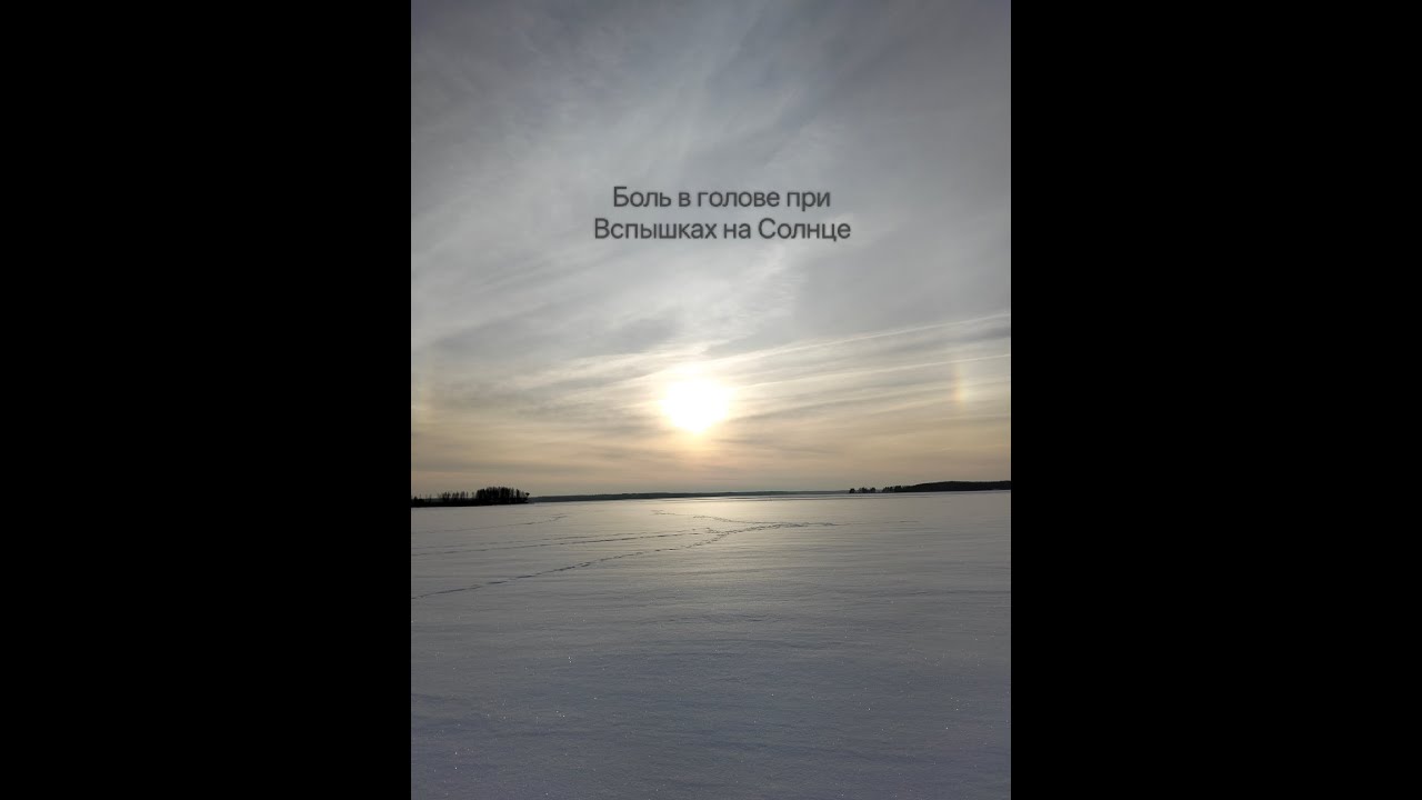 Боли лба или в затылке