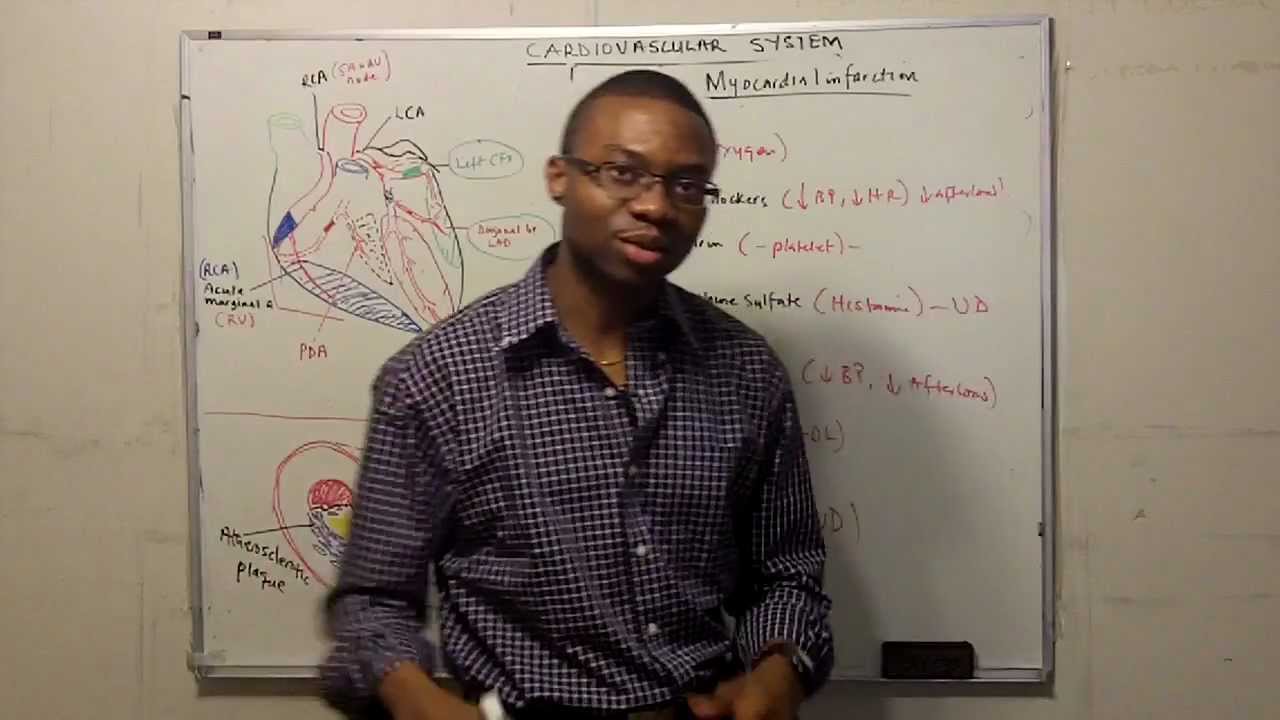 Management of Acute Myocardial Infarction (mneumonic)