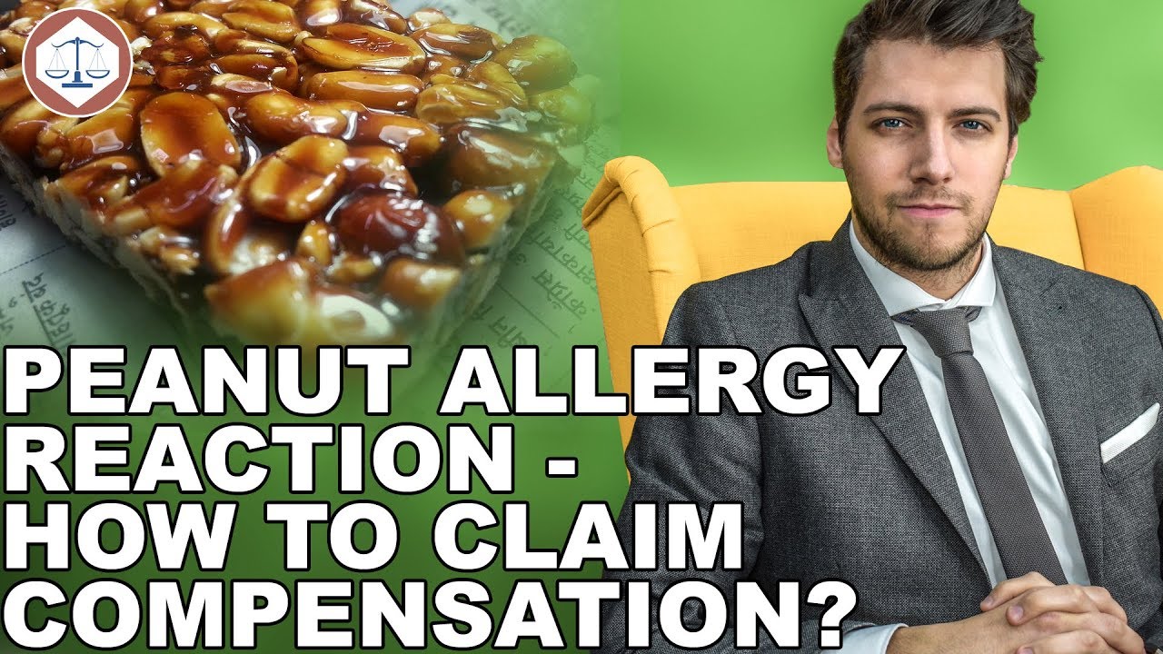 Peanut Allergy Reaction &ndash; How To Claim Compensation? ( 2019 ) UK