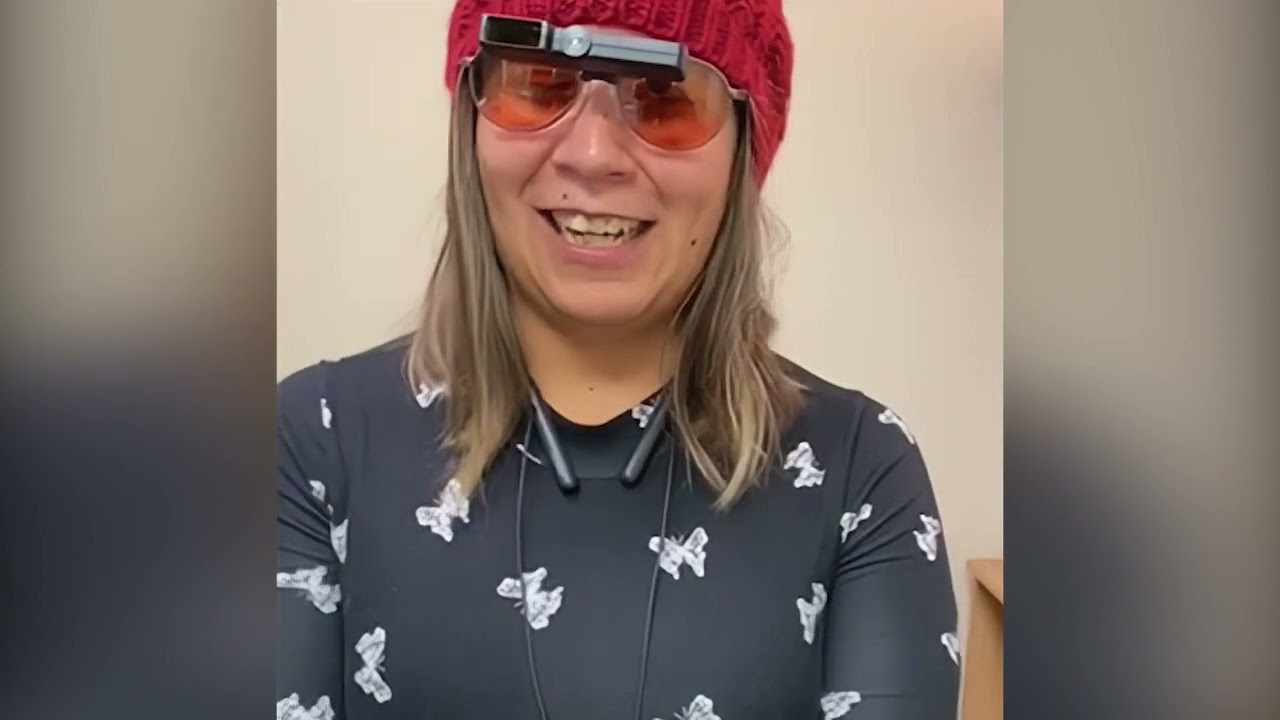 Maya has retinal dystrophy and is using a 4X VES Sport II bioptic telescope to see distance and near