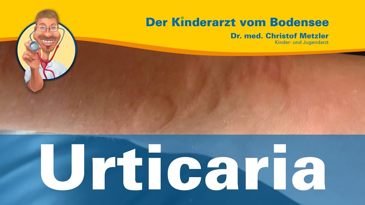 Urticaria - Der Kinderarzt vom Bodensee
