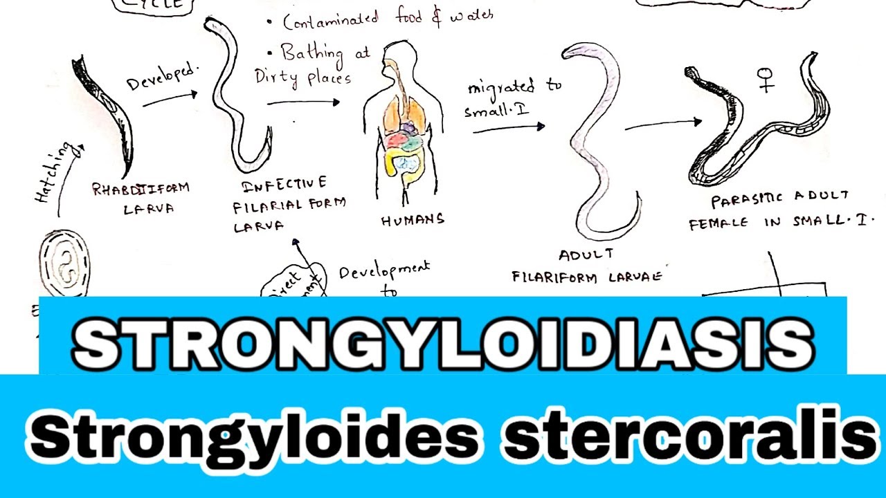 Strongyloidiasis | Life cycle, Symptoms, Treatment | Strongyloides stercoralis | Bio science