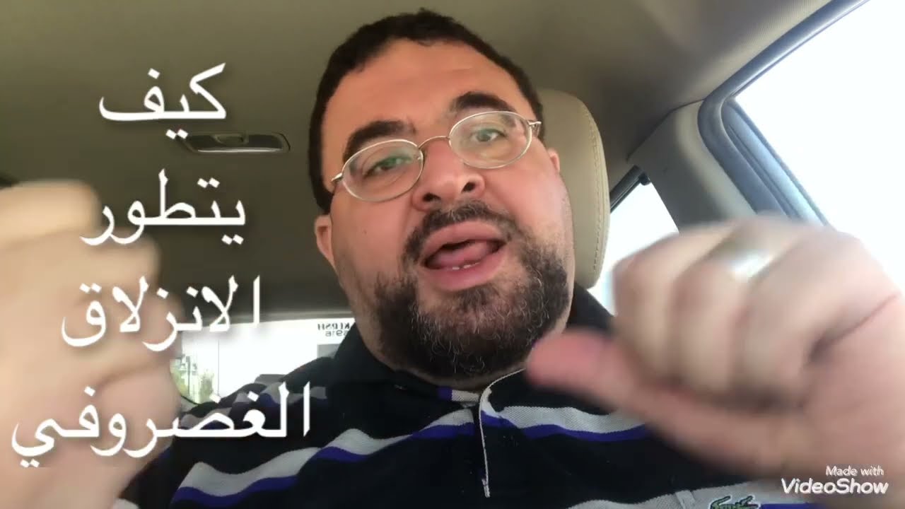 الحقيقه الغائبه عن مرضي الغضروف يكشفها اد/ محمد يسري - استاذ علاج غضروف الفقرات و الركبه بدون جراحه