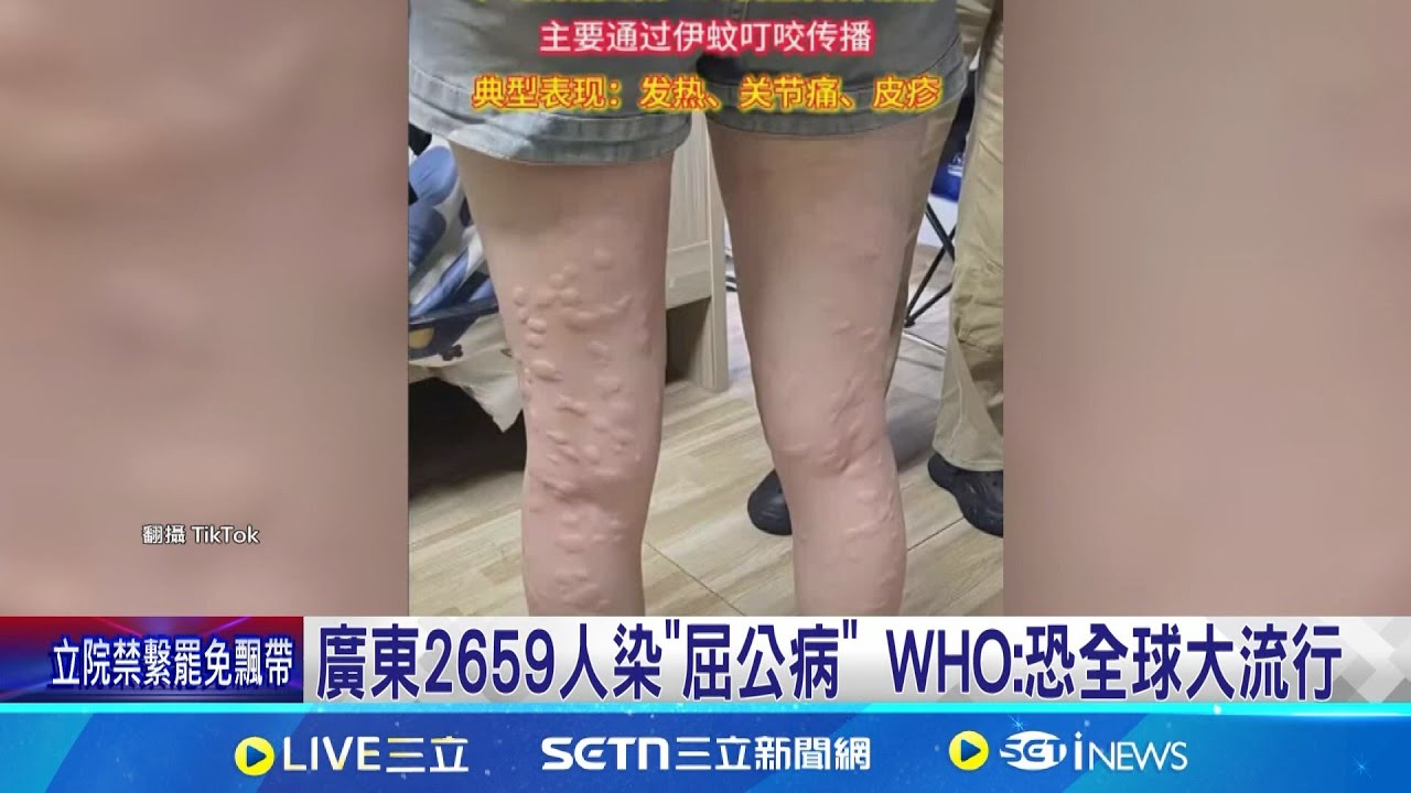 廣東2659人染