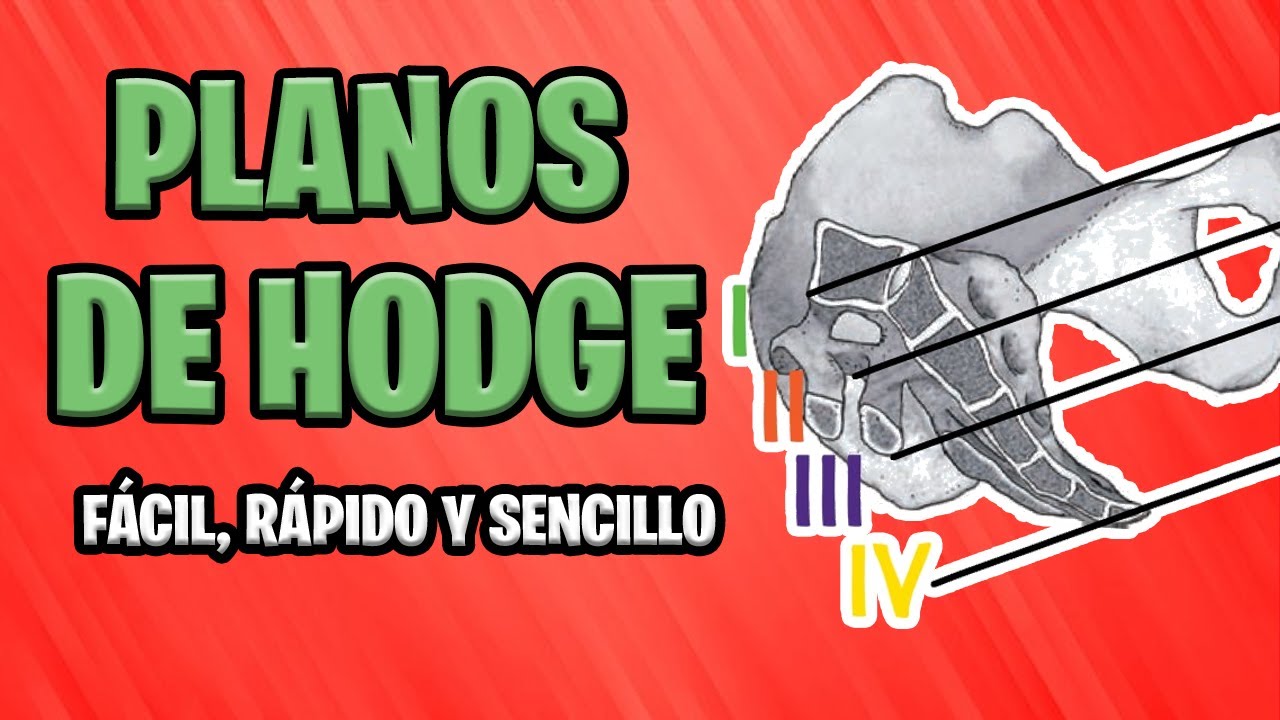 ✅ LOS PLANOS DE HODGE | OBSTETRICIA 👶
