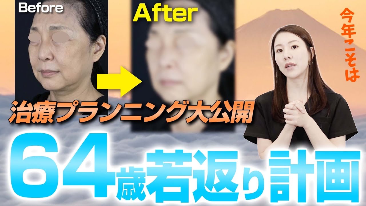 64歳女性を10歳若返りさせる治療計画について解説します。