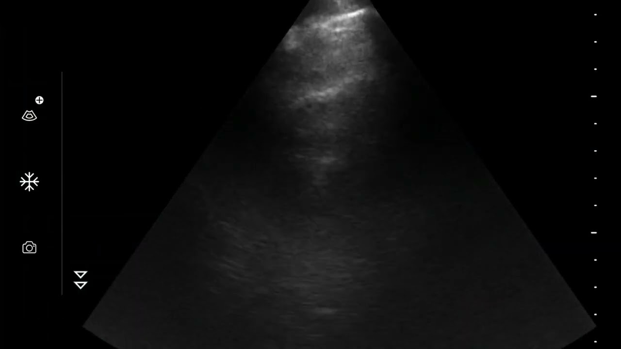 Vscan handheld ultrasound review