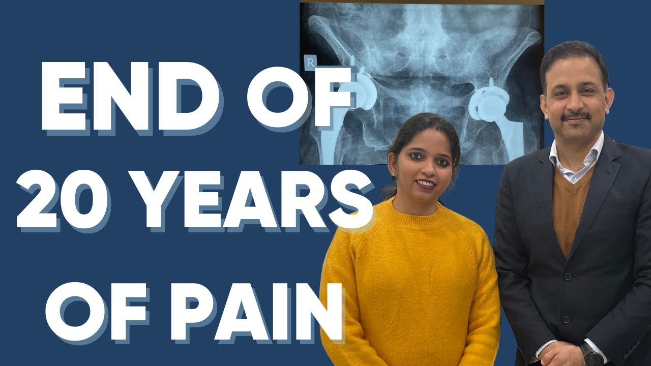 Bilateral Hip replacement in stiff hips & stiff spine | Ankylosing Spondylitis #totalhipreplacement