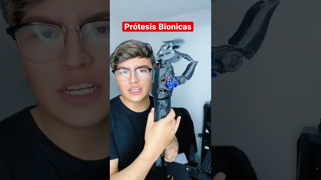 Pr&oacute;tesis Bionicas - Contenido Educativo