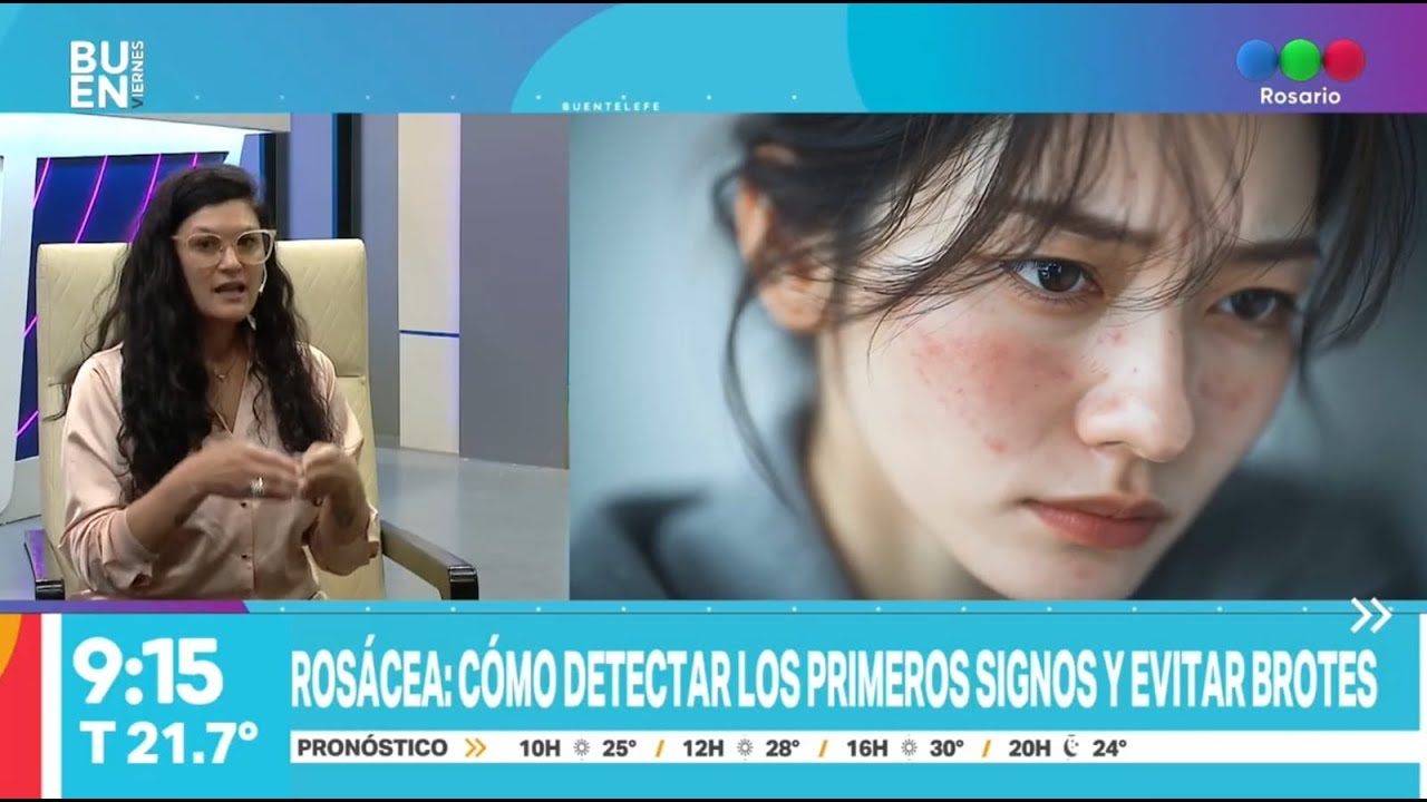 Piel sensible y rosácea: cómo cuidarla desde la Cosmiatria Funcional.