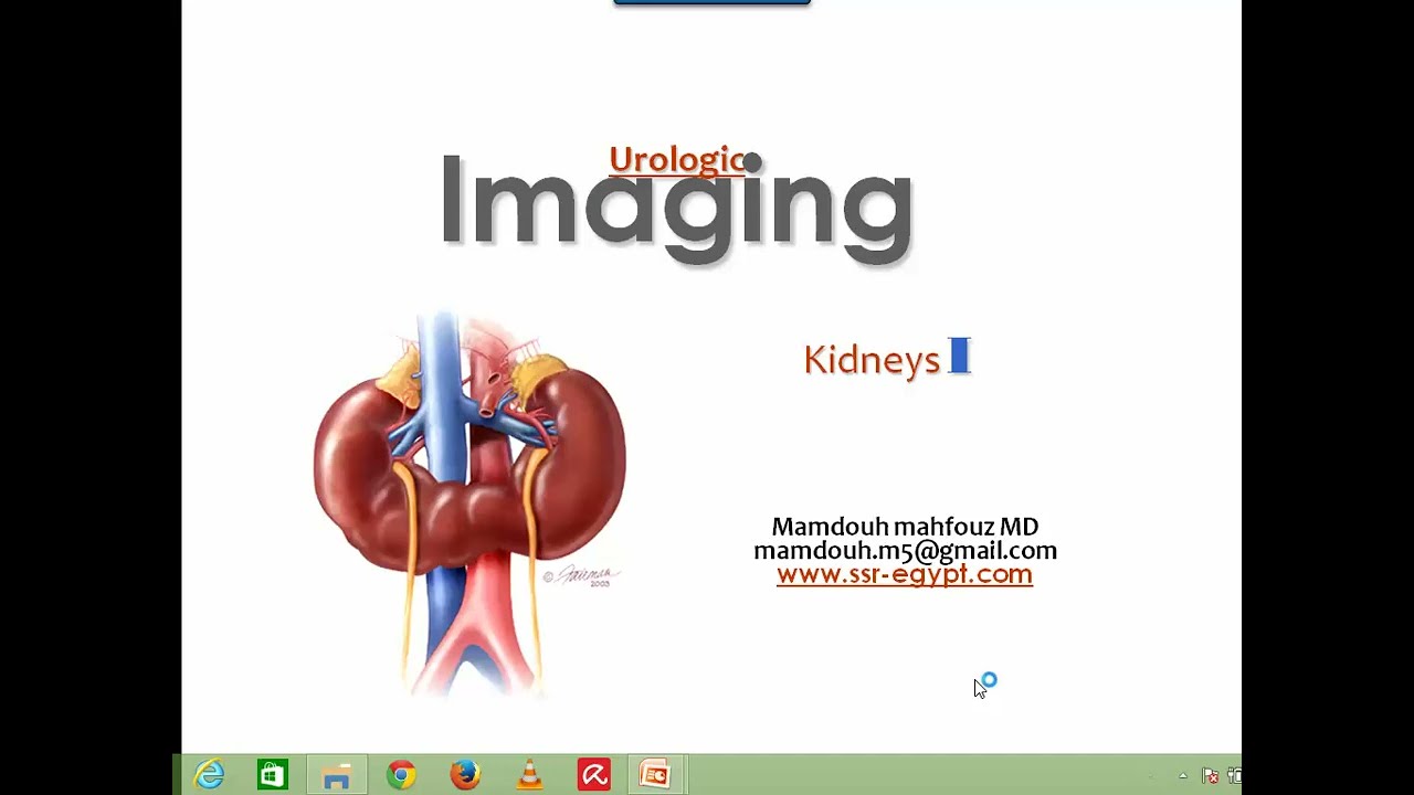 Renal imaging anatomy and pathology (I) (DRE) Prof. Mamdouh Mahfouz