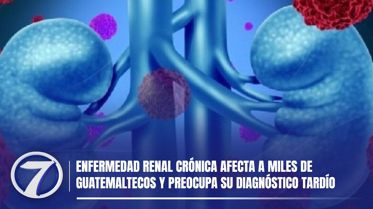 Enfermedad renal crónica afecta a miles de guatemaltecos y preocupa su diagnóstico tardío