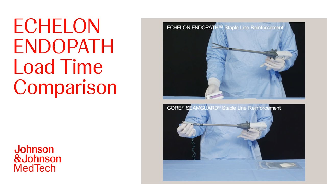 ECHELON ENDOPATH Staple Line Reinforcement Load Time Comparison | J&J MedTech