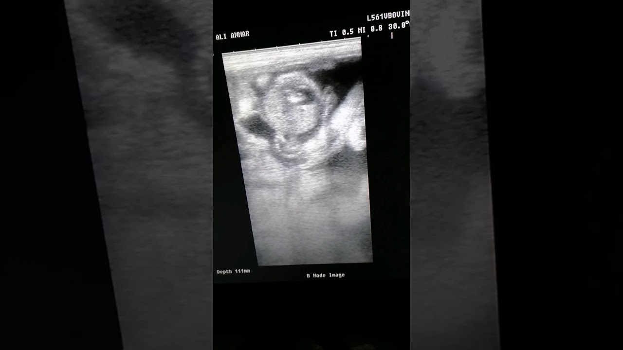 Goat pregnancy detection - Ultrasound ( Caprine) 80 days