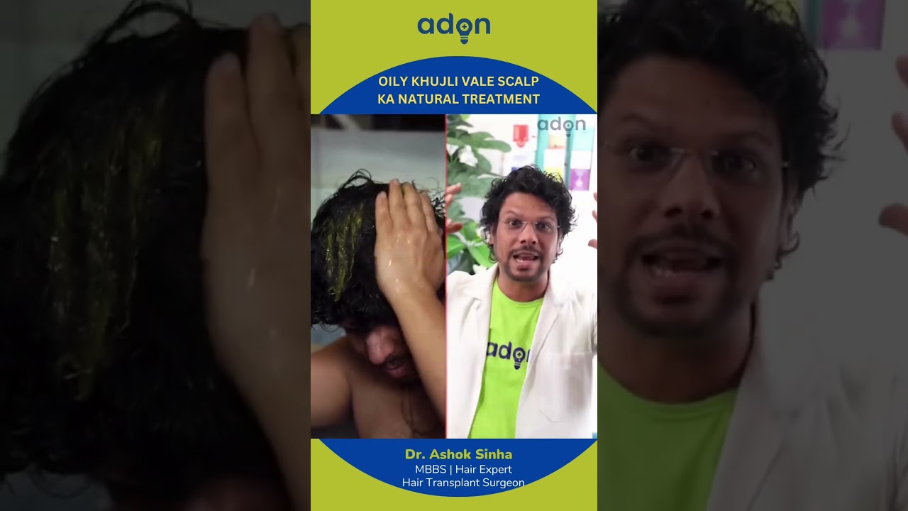 Homemade Treatment for oily scalp! Hair loss | Hair Regrowth | Hair Tips #adonhaircare #viral