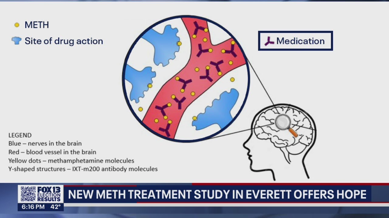 Everett ER patients join study for new meth treatment drug that offers hope for combating addiction
