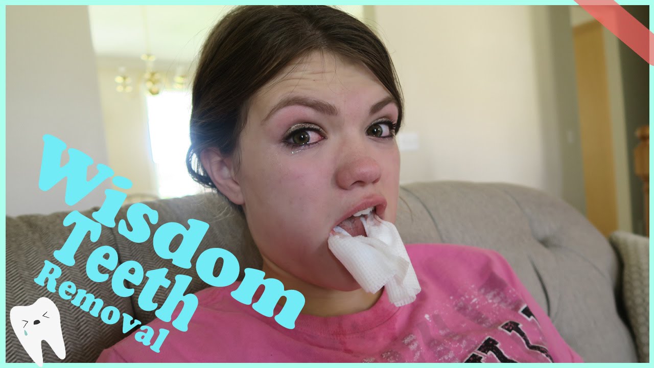 WISDOM TEETH REMOVAL- FUNNY REACTION!