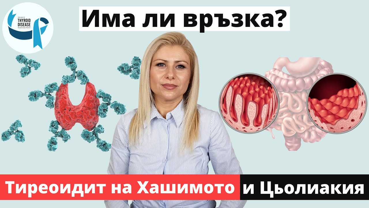 Тиреоидит на Хашимото и Цьолиакия (Има ли връзка между тях и в какво се изразява тя)